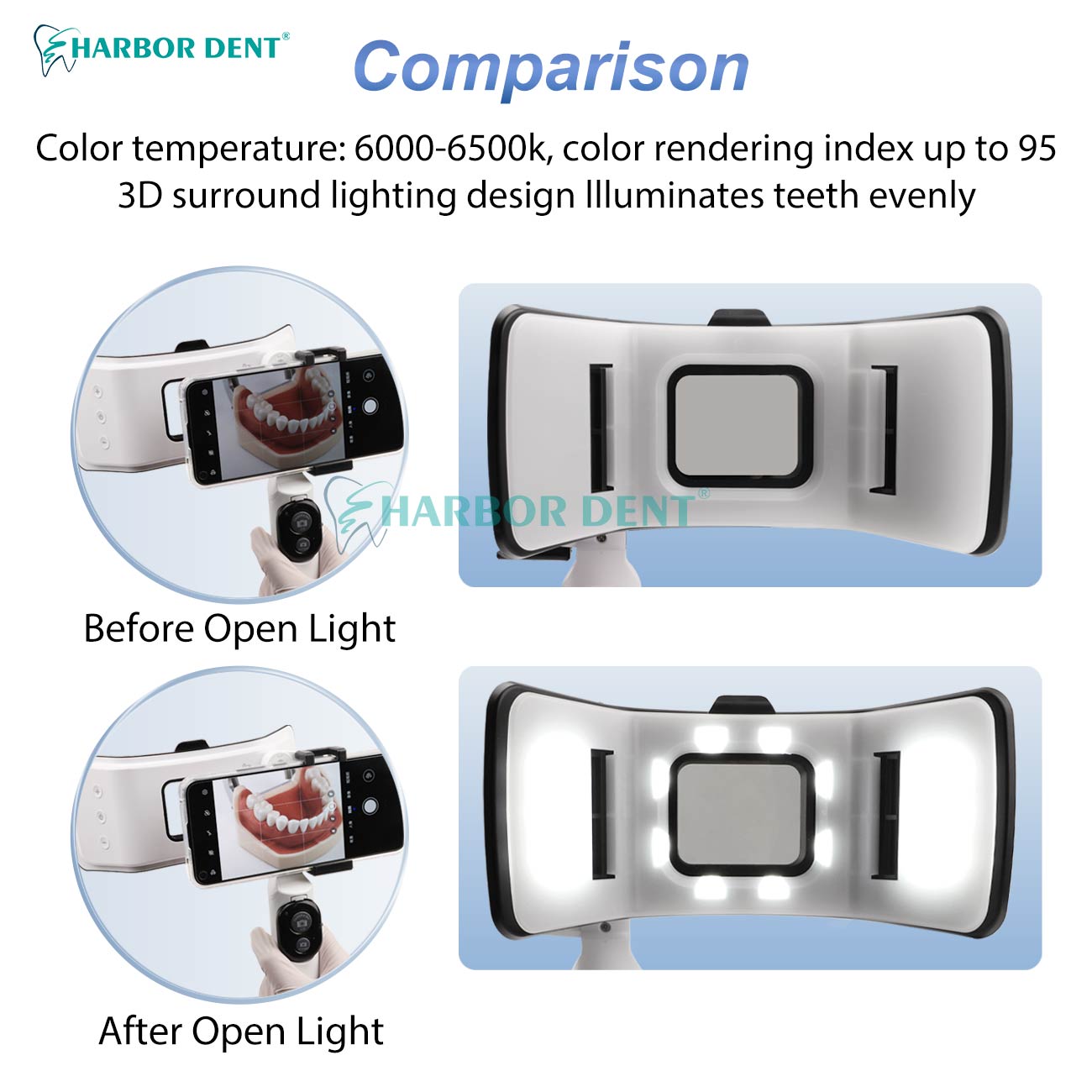 좋은 가격의 치과 사진 촬영용 트윈 플래시 키트, 밝기 - Good Lighting In Photography 리뷰 및 가격