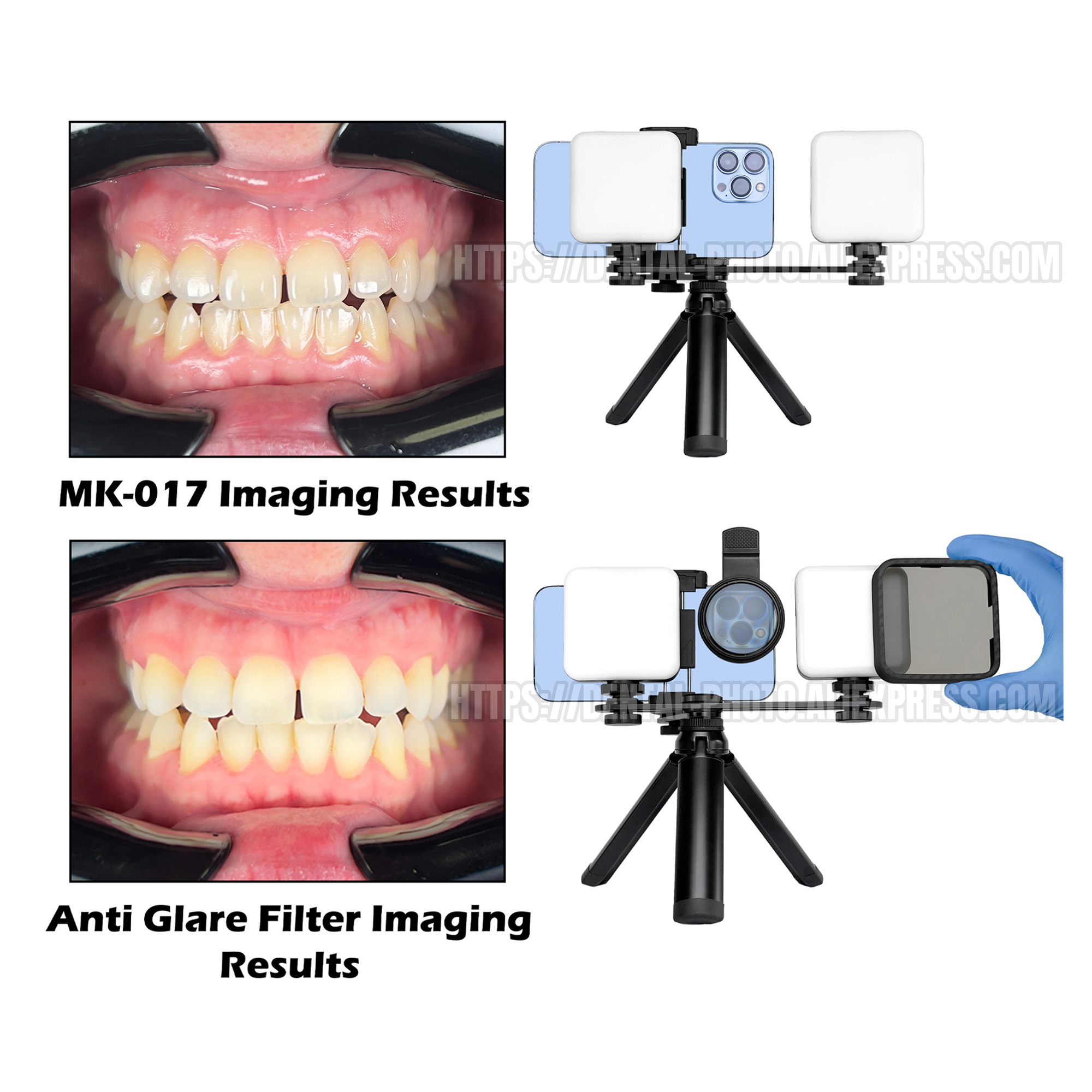 헤라 모바일폰 사진촬영용 LED 조명, 치과 사진, 매 - Photography Mobile Lighting 리뷰 및 가격
